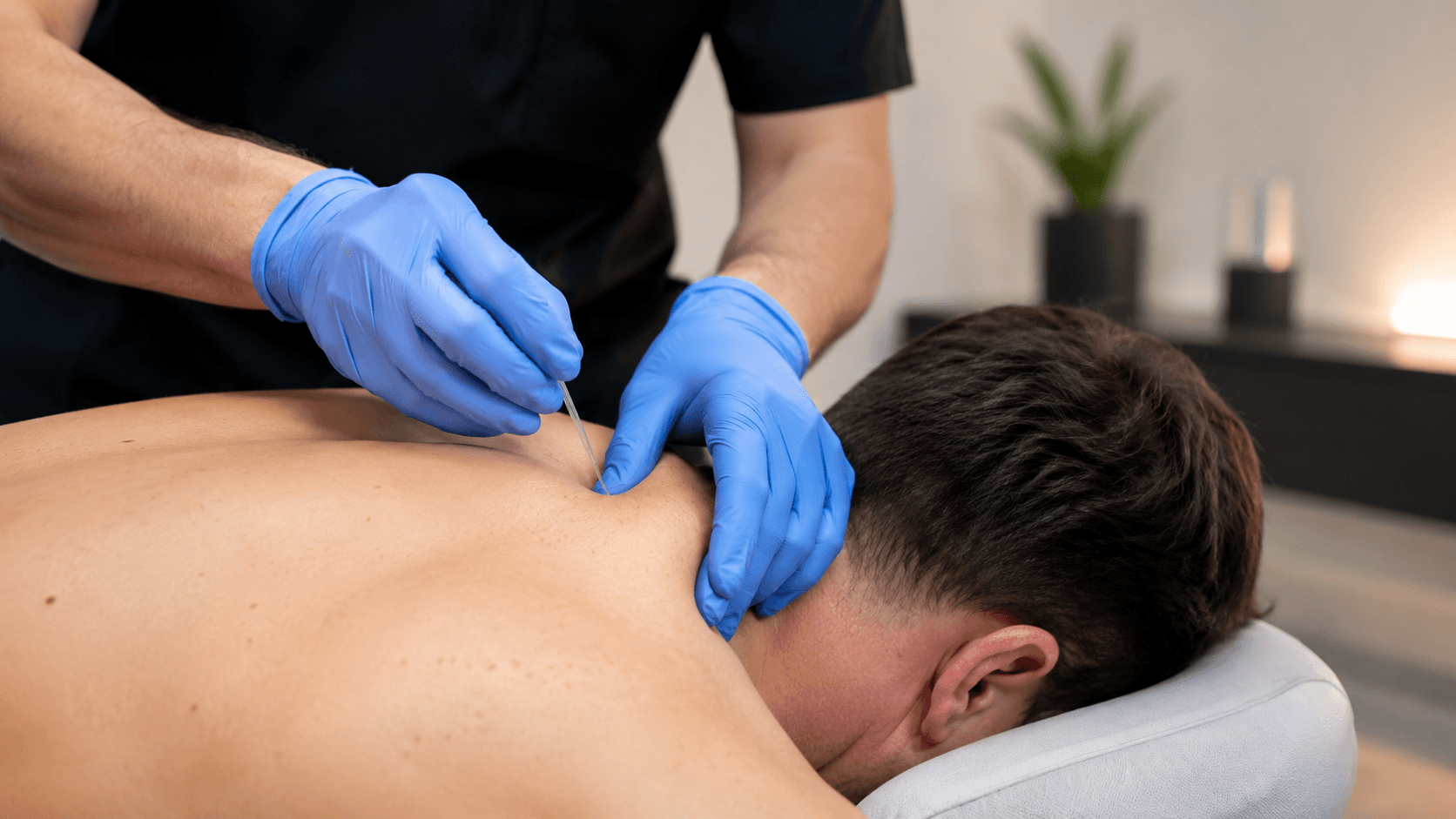 Dry Needling Image